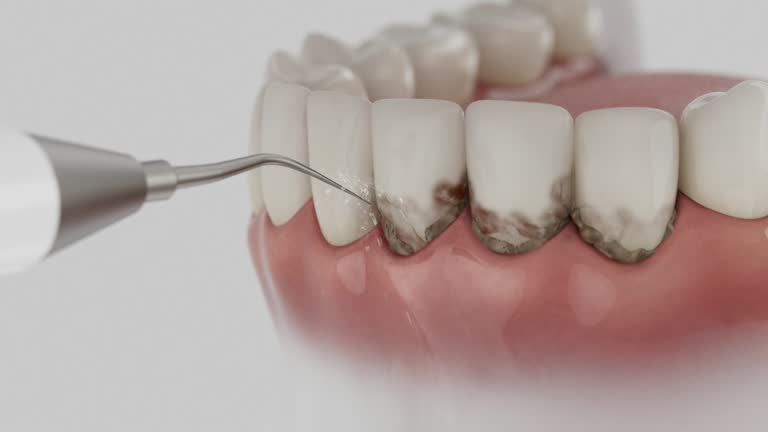 Trusted Dental Crowns And Bridges service in Seven Points, TX - Dentist Open Now